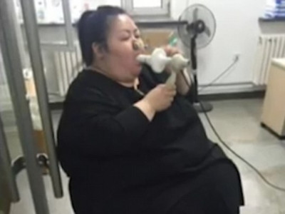 224 кг жинтэй эмэгтэй мэс заслын аргаар жин хасах болжээ