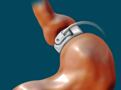 Хуримандаа бэлдэж 50 кг жин хаясан сүйт бүсгүй