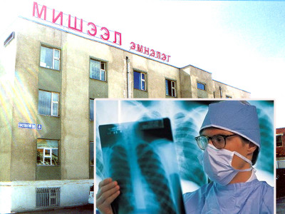 Сүрьеэгийн халдварыг эмнэлэг тарааж байна уу? (II)