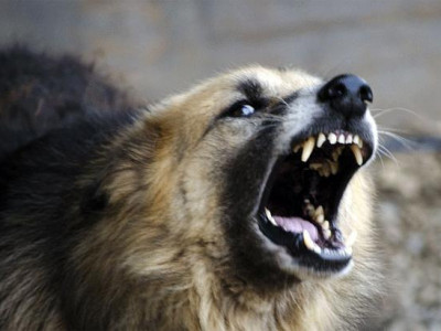 10 настай хүүхэд нохойд ноцуулжээ