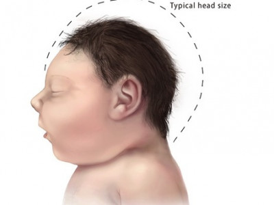 Үр хөндүүлэхийг зөвшөөрөхийг шаарджээ