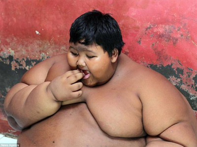 Хамгийн тарган хүүхэд хоолны дэглэм барив