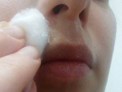 Нүүрний илүүдэл үсийг авах хялбар арга