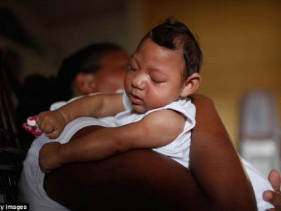 АНУ-д зикагийн халдвартай хүүхдүүд мэндэлжээ