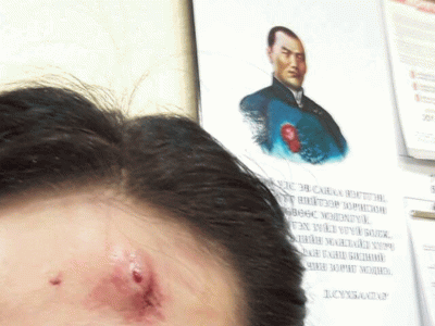 Сүхбаатар дүүргийн МАН-ынханд зодуулсан эмэгтэйн бие муу байна