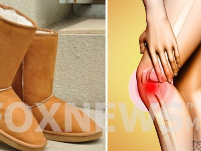 Мэс заслын эмч нар эмэгтэйчүүдийг UGG гутал өмсөхгүй байхыг анхааруулж байна. Шалтгаан нь маш аймшигтай!