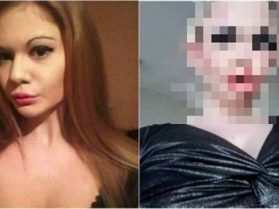 Дэлхийн хамгийн том уруултай болгар бүсгүй 