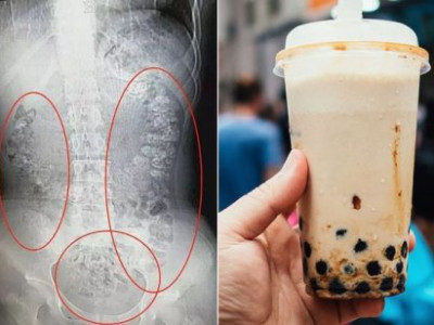 Bubble tea-г хэтрүүлэн хэрэглэж болохгүй