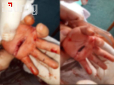 УОК ! ОО ТУСГААРЛАЛТАД БАЙГАА ХҮҮГ ЯАРАЛТАЙ ХАГАЛГААНД ОРУУЛАХ ШААРДЛАГАТАЙ БАЙНА