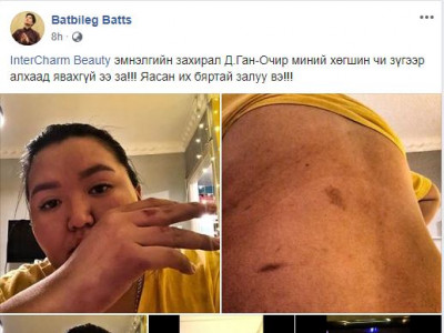 Оляд гар хүрч, комедиан Батааг бухимдуулсан эр хэн бэ
