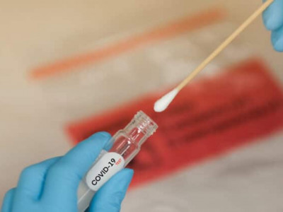 Хувийн эмнэлгүүд PCR шинжилгээ нэрээр бизнес хийж байна