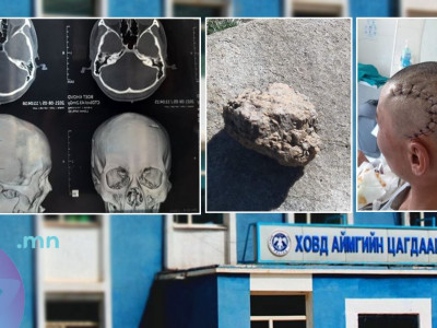 Зургуулаа нийлж Гавлын ясыг нь цөмөртөл нь зодсон байхад хэргийн газрын үзлэг ч хийгээгүй