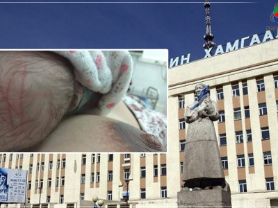 ИРГЭН Л: ЭХЭМҮТ-ИЙН ЭМЧ НАР ХҮҮХДИЙН МИНЬ ЗУЛАЙГ ЗҮСЭЖ, АРХАГ ЦОЧИМТГОЙ БОЛГОЧИХООД ХАРИУЦЛАГА ХҮЛЭЭГЭЭГҮЙ