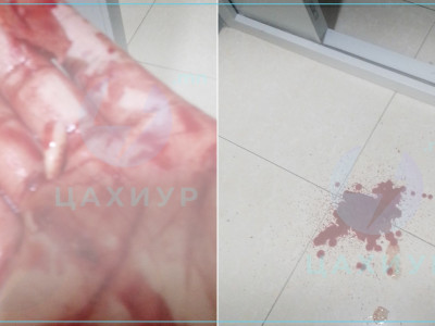 Иргэн: Мөнгөгүй хүн хүнд зодуулбал зүгээр хохь нь л болдог хорвоо юм байна