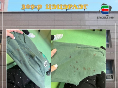 Нийслэлийн 309-р цэцэрлэгийн багш Д дөрвөн настай хүүхдийг удаа дараа зодсон хэрэг прокурорт шилжжээ