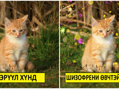 Шизофренийн талаарх буруу ойлголтын улмаас лам, бөөд үзүүлэх зэргээр хугацаа алдаж, өвчнийг хүндрүүлдэг 