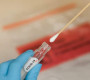 Хувийн эмнэлгүүд PCR шинжилгээ нэрээр бизнес хийж байна
