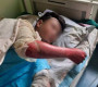 Банкны картын пин кодыг хэлүүлэхийн тулд зодож, улмаар дээрээс нь шатамхай шингэн цацан шатаажээ