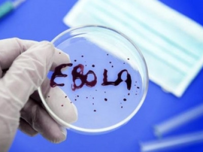 Дэлхий нийтийг түгшээсэн “Эбола” вирус