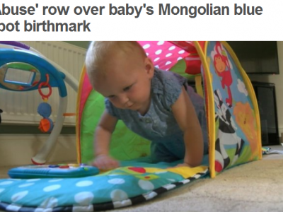 Англид Монголын хөх толботой хүүхэд мэндэлсэн гэж BBC онцлов