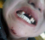 Наймдугаар ангийн хөвгүүд зодолдож, нэгнийхээ 4 шүдийг булгалжээ